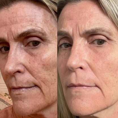 Social Skin 3-in-1 LED Light Therapy Face Mask